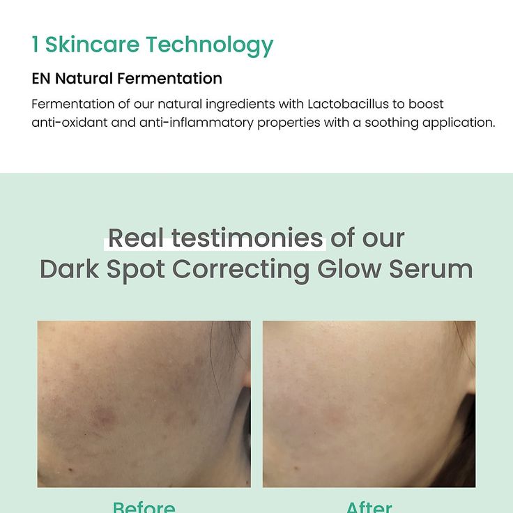Axis-Y Dark Spot Correcting Glow Serum Dark Spot Treatment